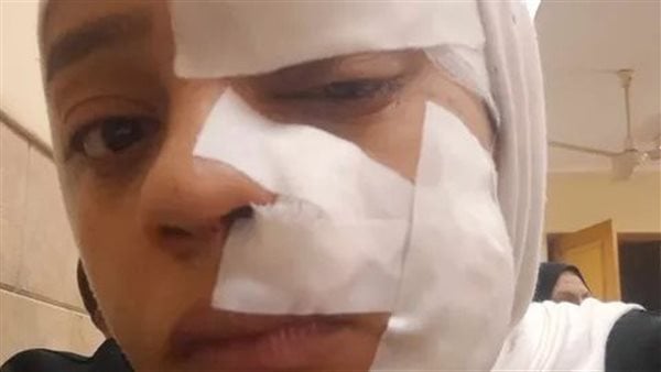 بسبب قضية خلع قطع وشها.. تجديد حبس المتهم بالتعدي على زوجته في الغربية 15 يومًا