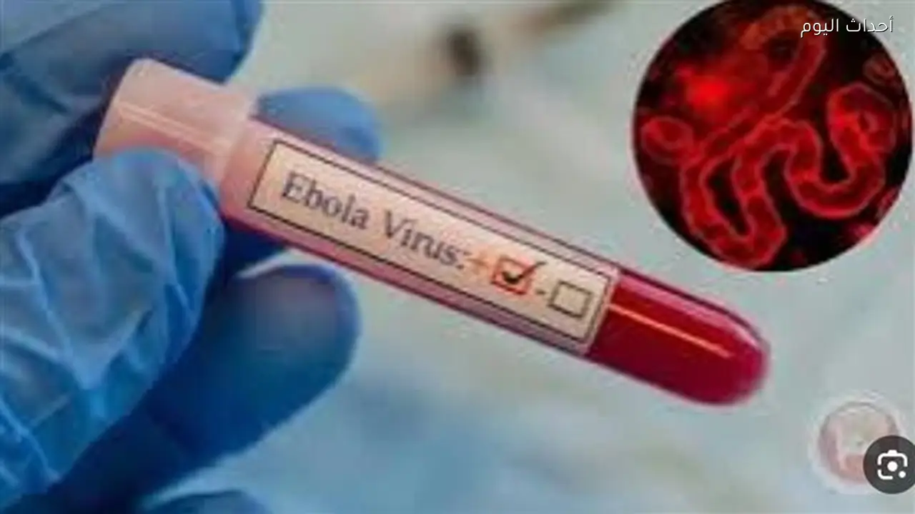 عاجل.. إسرائيل تعلن تسجيل أول حالة اشتباه بفيروس إيبولا