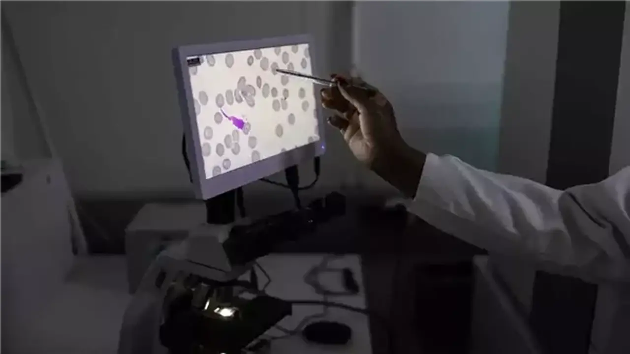 اكتشاف جديد يغير فهمنا لآلية إصابة الملاريا بخلايا الدم الحمراء