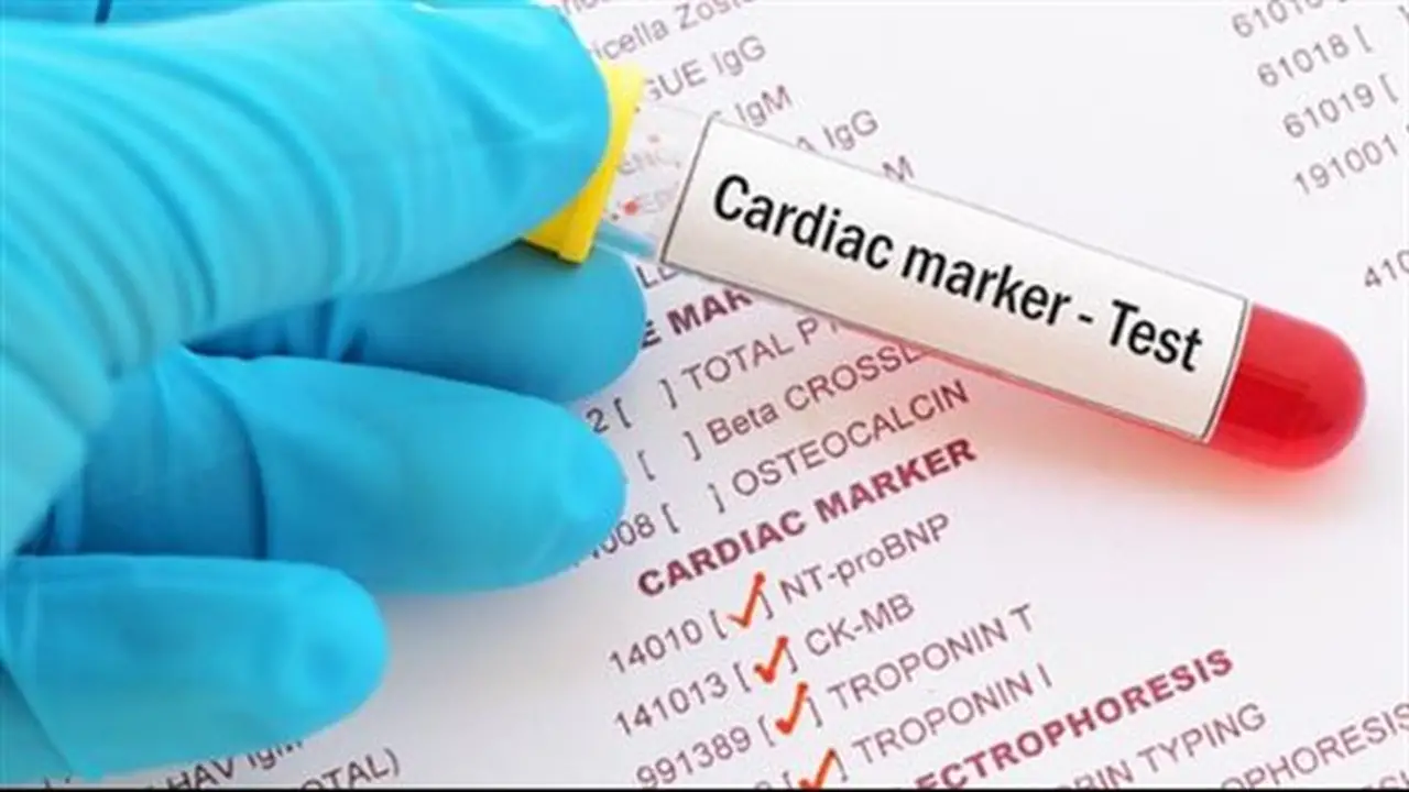 أعراض وأسباب ارتفاع أنزيمات القلب ومخاطرها