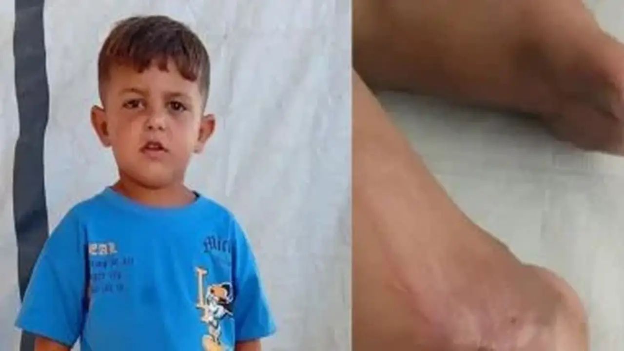 يزن علوان: طفل فلسطيني يواجه الألم في انتظار العلاج خارج غزة