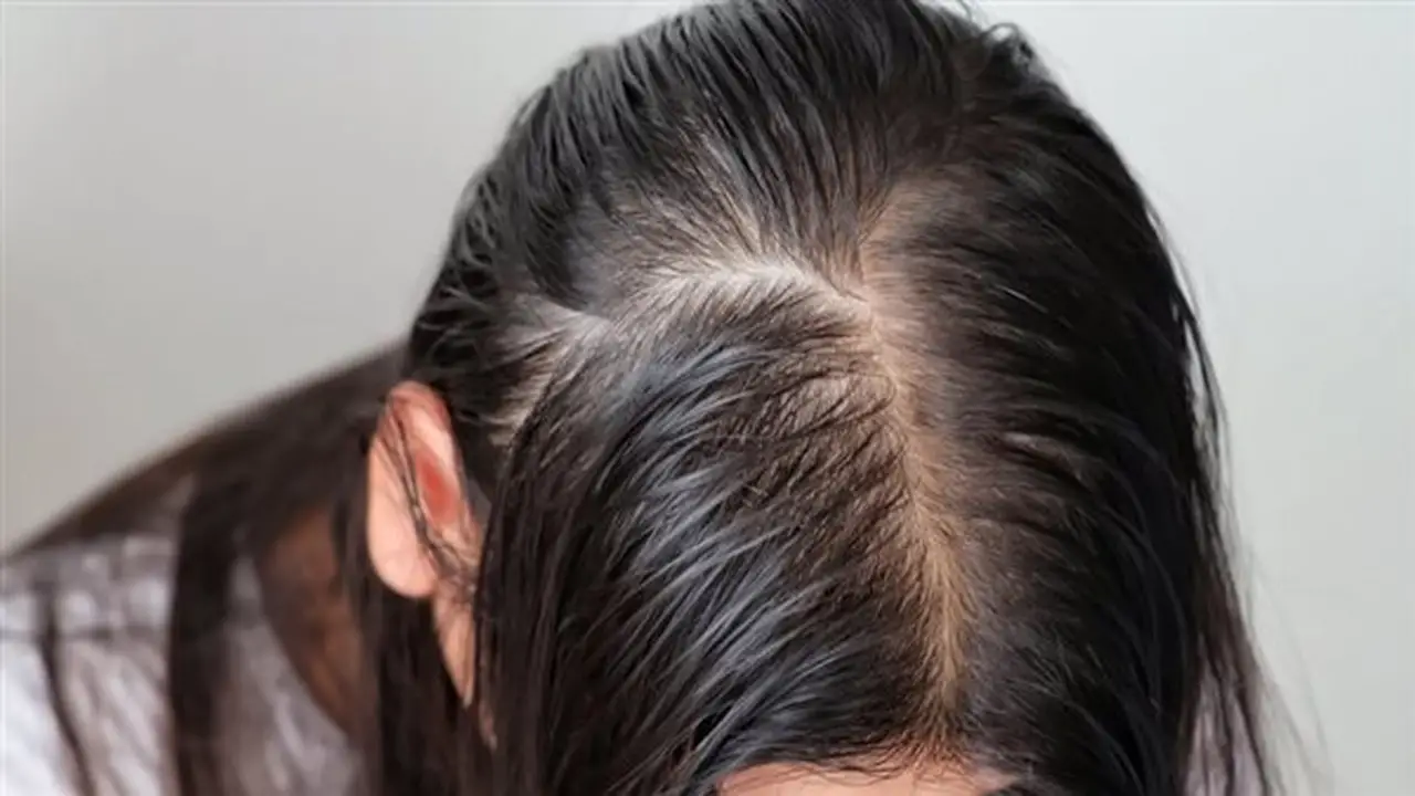 سيروم القرنفل: الحل الأمثل لتقوية الشعر وإعادة إنباته