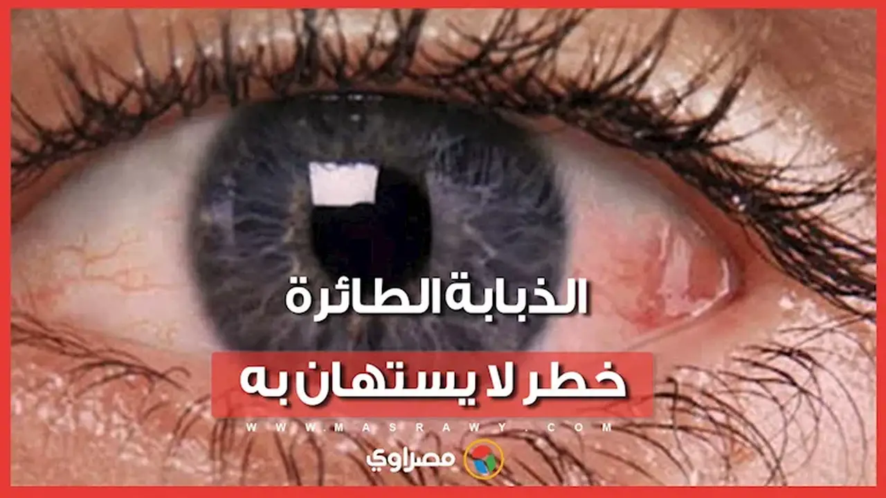 الذبابة الطائرة: خطر يهدد صحة العيون، تفاصيل من الدكتور إيهاب سعد أستاذ العيون بجامعة القاهرة