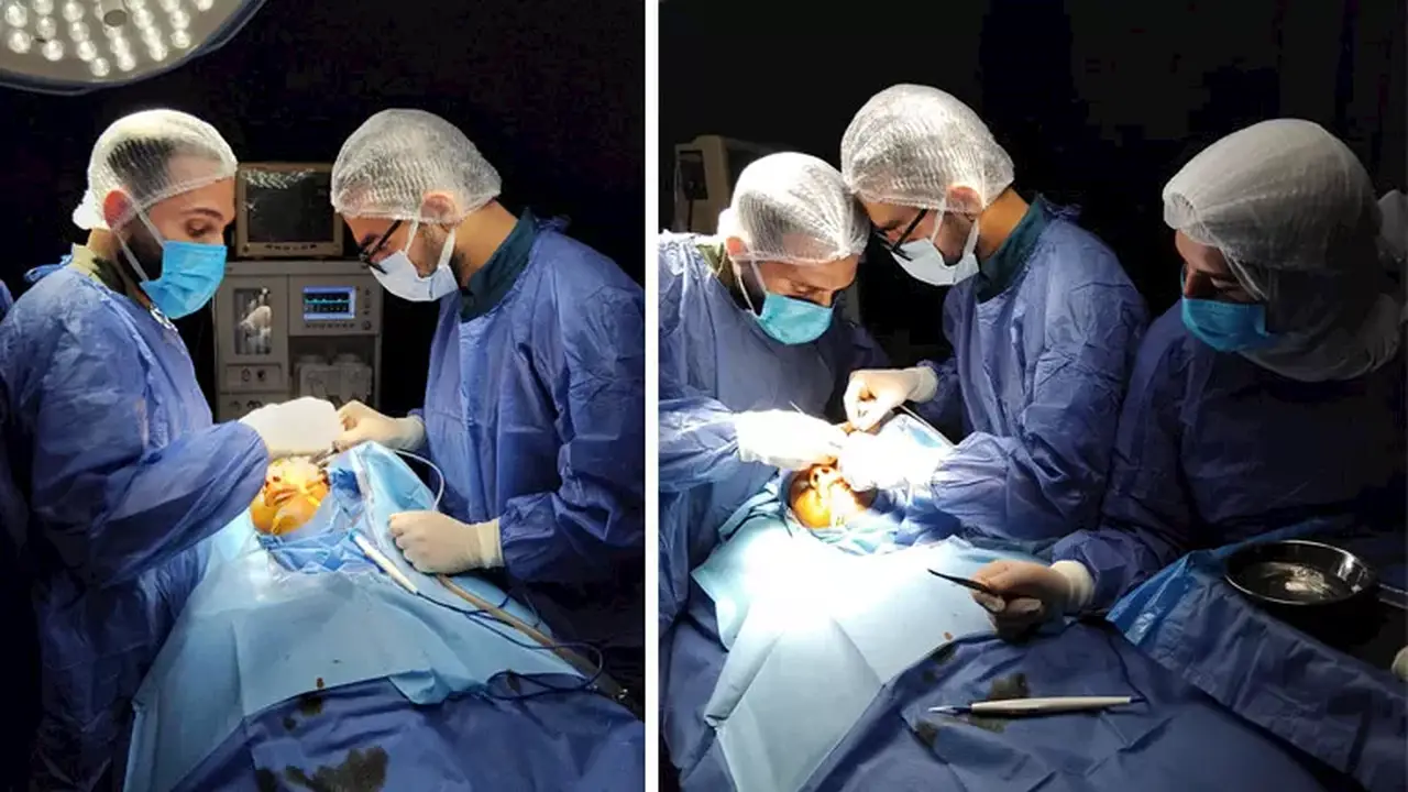 جراحة معقدة لإنقاذ شاب في الدقهلية بعد انفصال وجهه عن الجمجمة – صور