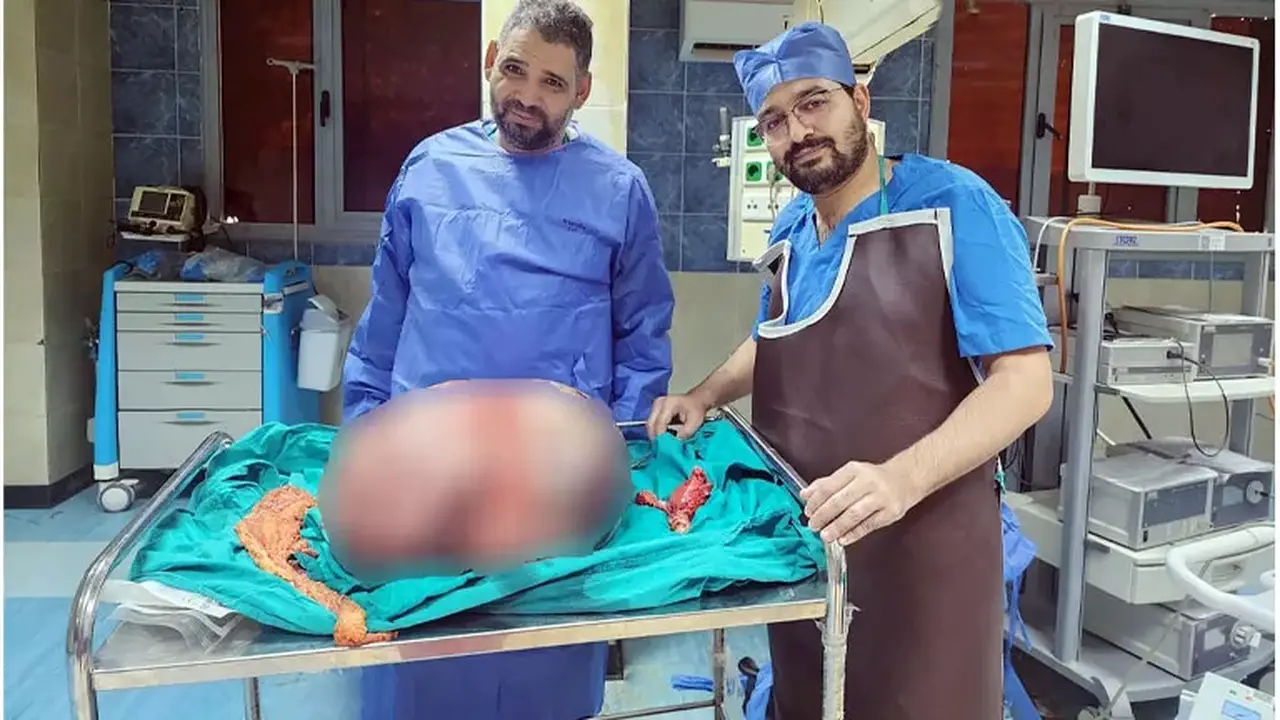 تكريم فريق طبي بجامعة المنيا بعد استئصال ورم مبيضي ضخم يزن 24 كيلوغرامًا