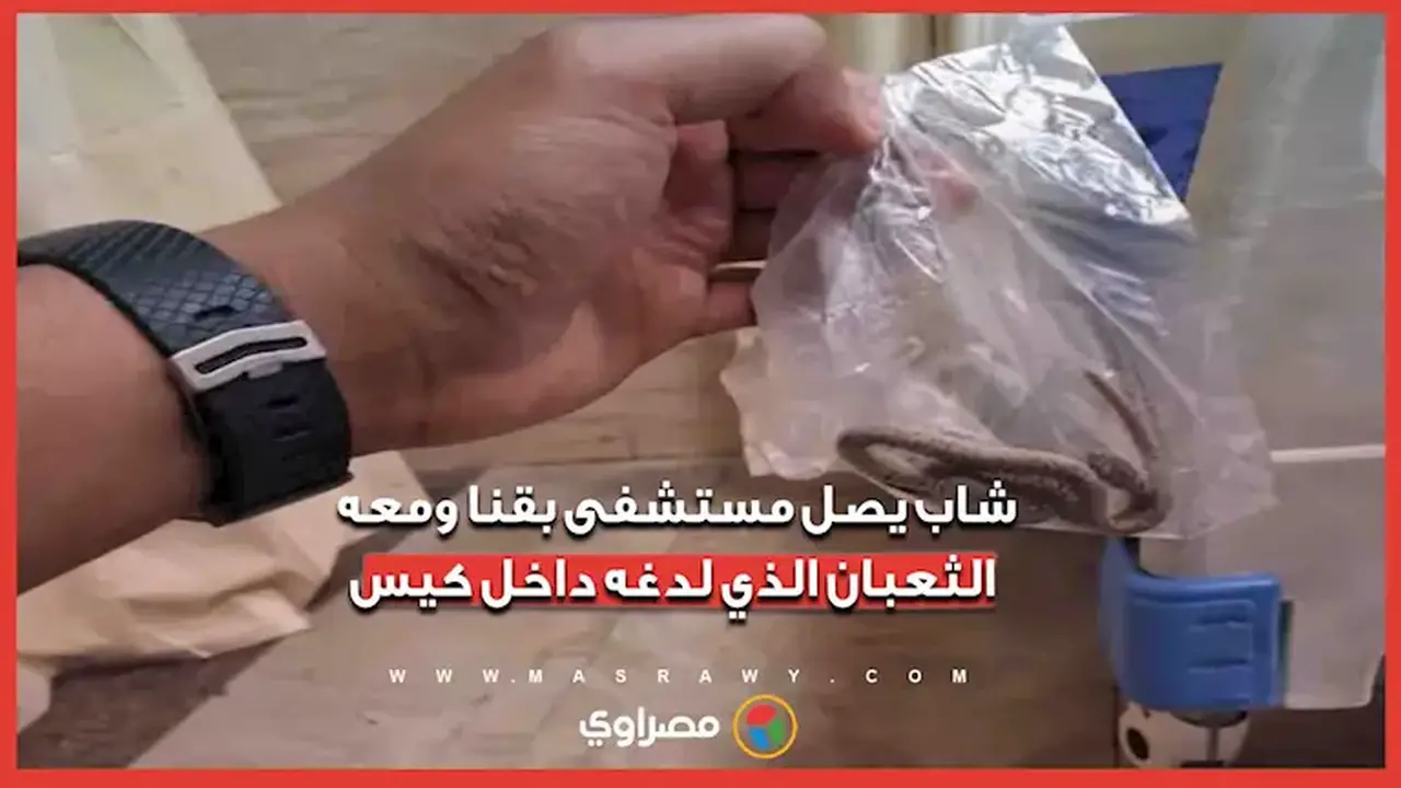 شاب يصل مستشفى بقنا ومعه الثعبان الذي لدغه في كيس