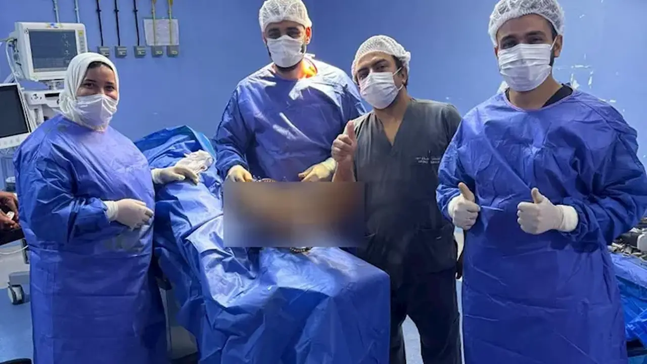 نجاح مستشفى بلبيس المركزي في إجراء أول عملية لتثبيت كسور مضاعفة باستخدام جهاز إليزاروف